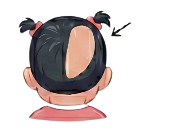 השטחת גולגולת והעדפת צד